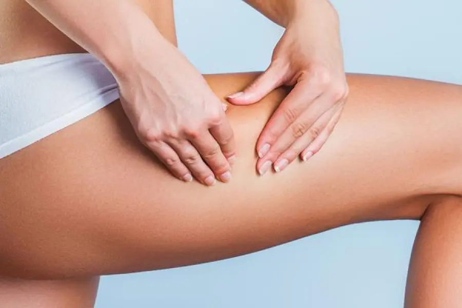 Rimedi per la cellulite: come fare per sconfiggerla?