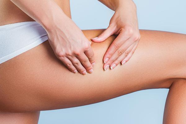 Rimedi per la cellulite: come fare per sconfiggerla?